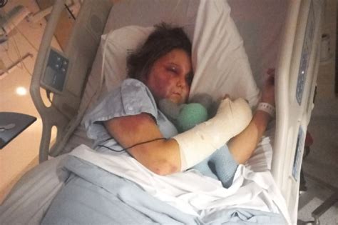 kirra hart now|Kirra Hart: Teenager who was brutally tortured for。